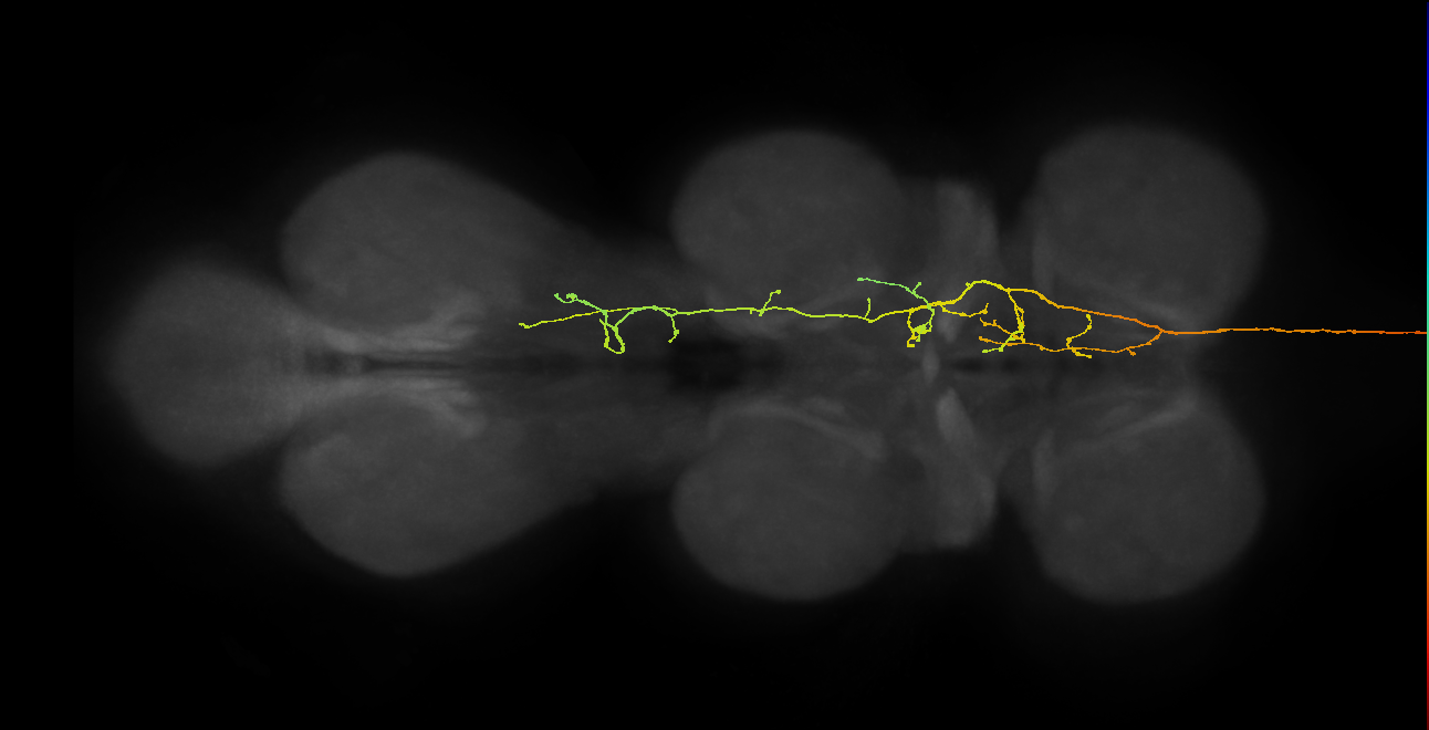 DNpe028(IB046)_R (MaleCNS:14399)