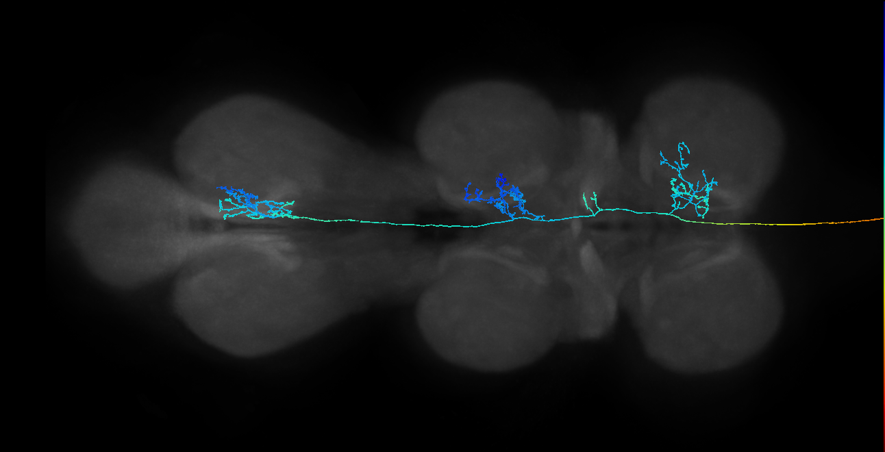 DNpe029_R (MaleCNS:38781)