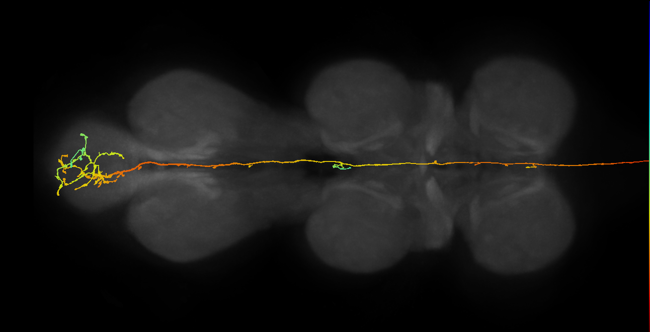 DNpe034(SMP486_b)_L (MaleCNS:13249)