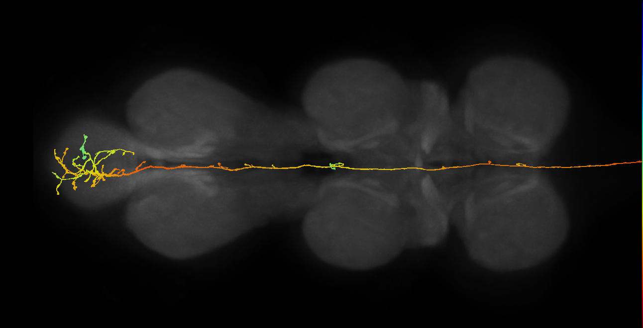 DNpe034(SMP486_b)_R (MaleCNS:10578)