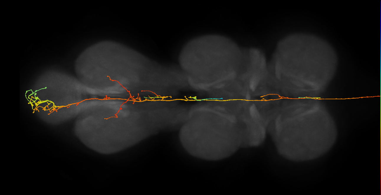 DNpe036_R (MaleCNS:47693)
