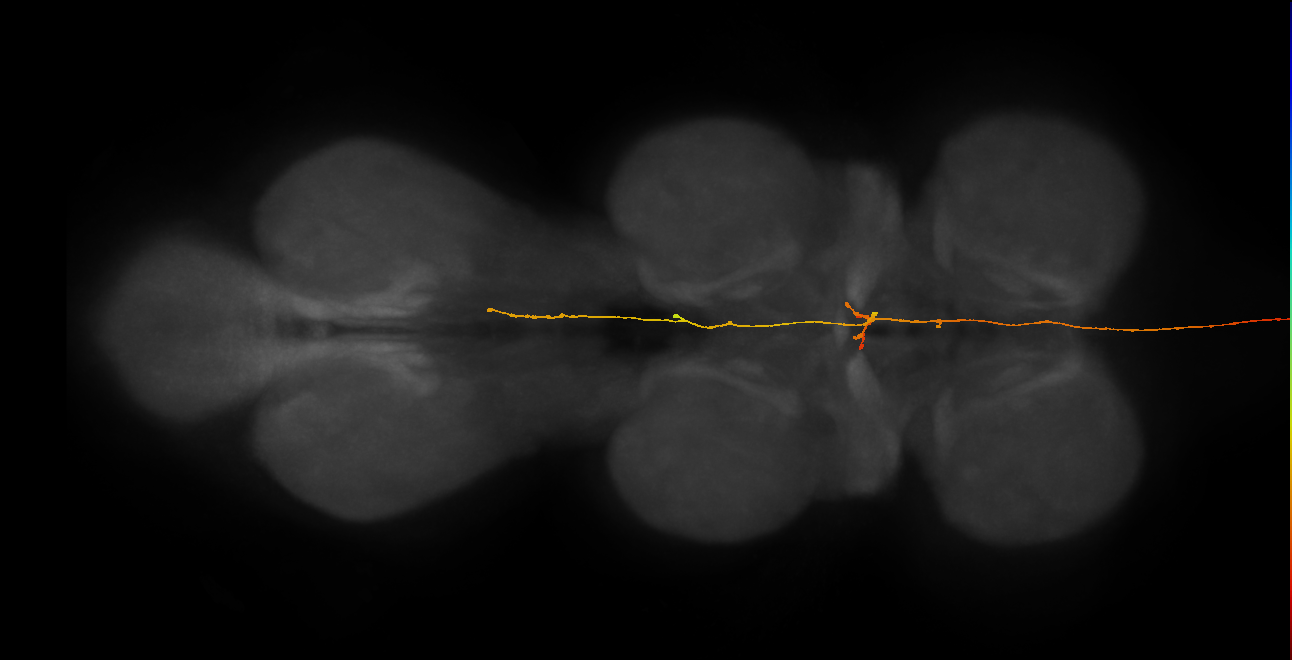 DNpe037(CL338)_L (MaleCNS:522345)