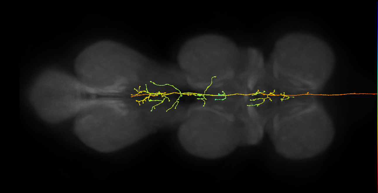 DNpe043(CL207)_L (MaleCNS:11251)