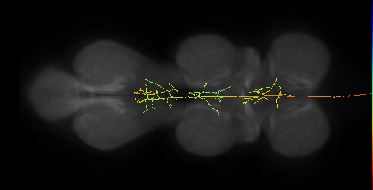 DNpe043(CL207)_R (MaleCNS:12707)