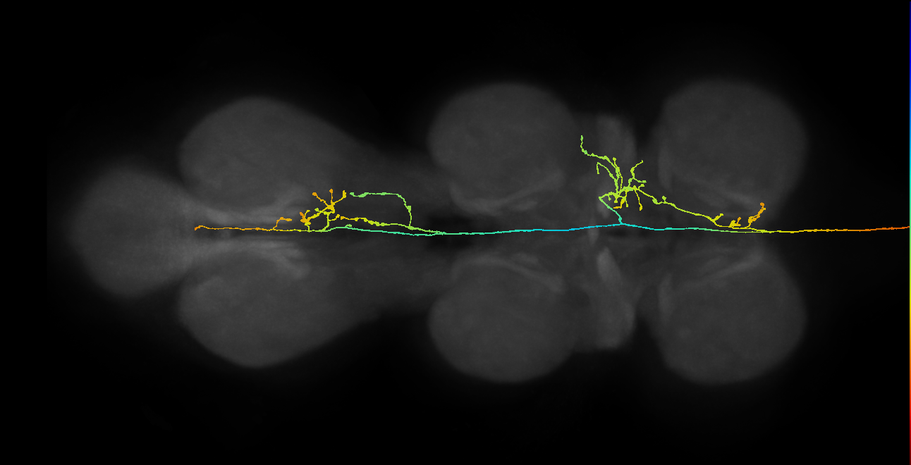 DNpe050(CL341)_R (MaleCNS:12177)