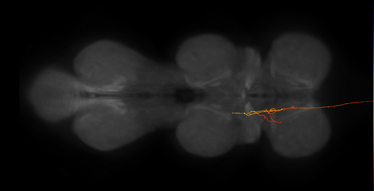 DNpe057(PS226)_L (MaleCNS:78641)