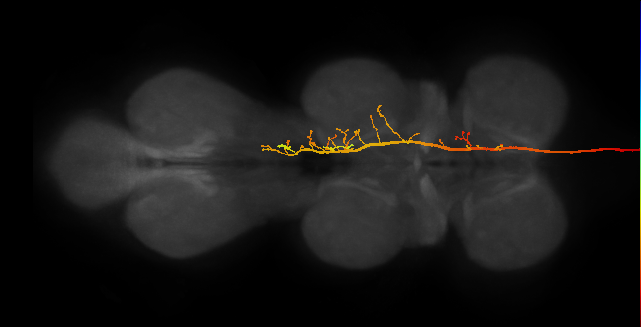 DNae002(DNa04)_R (MaleCNS:521262)