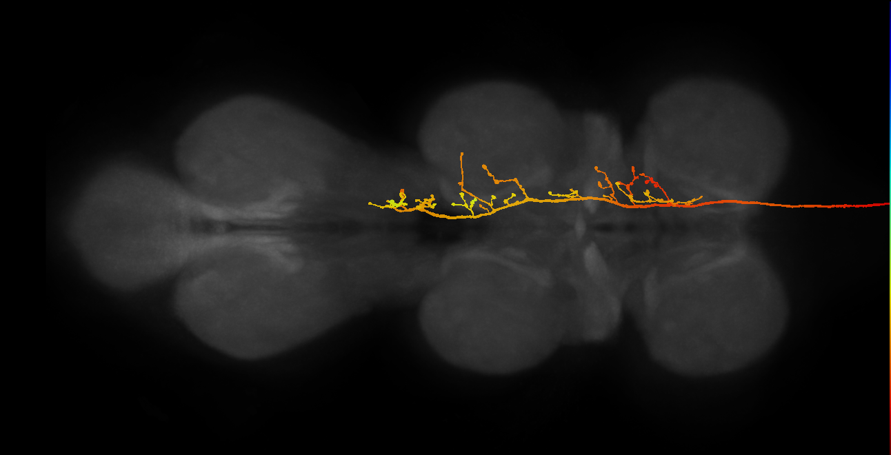 DNae003(PS040)_R (MaleCNS:11314)
