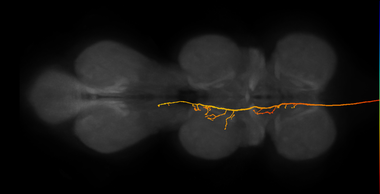 DNae004(DNa05)_L (MaleCNS:14239)