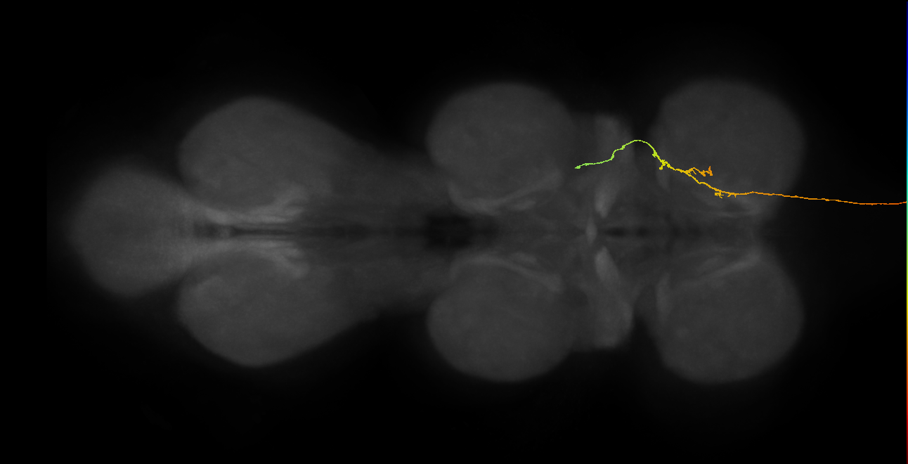 DNde003(LAL106)_R (MaleCNS:12995)