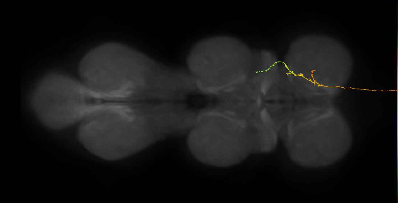 DNde003(LAL107)_R (MaleCNS:14264)