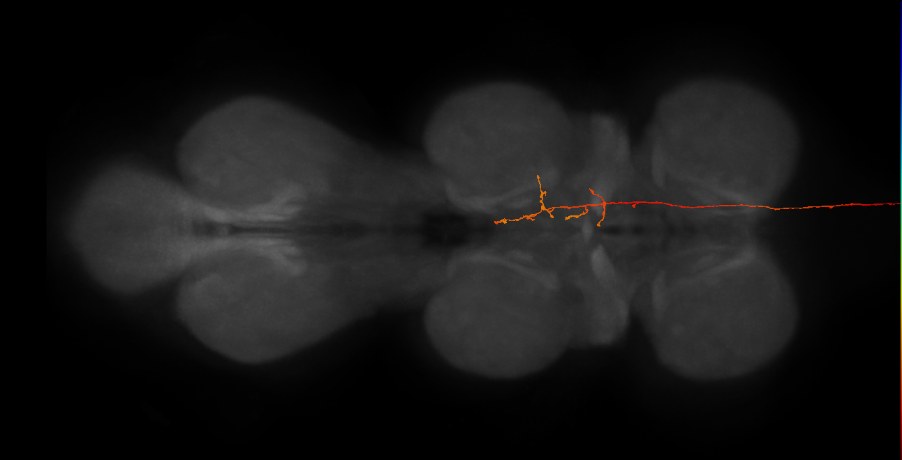 DNg06_R (MaleCNS:36172)