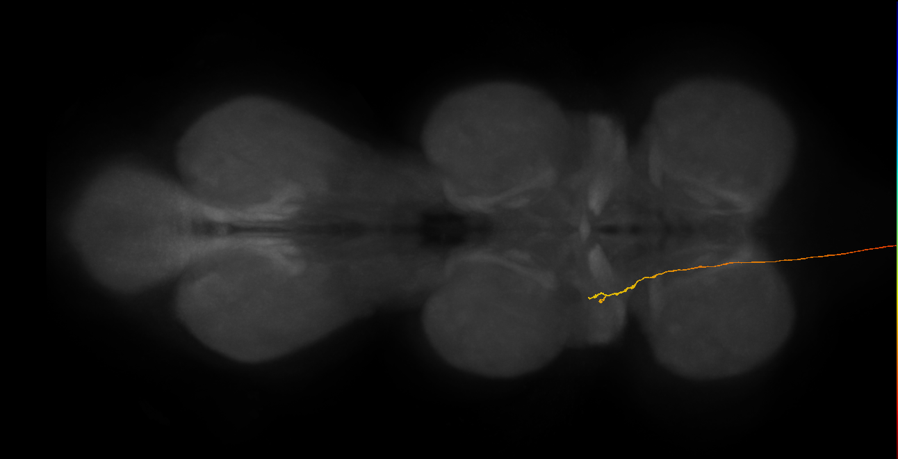 DNg07_R (MaleCNS:28949)