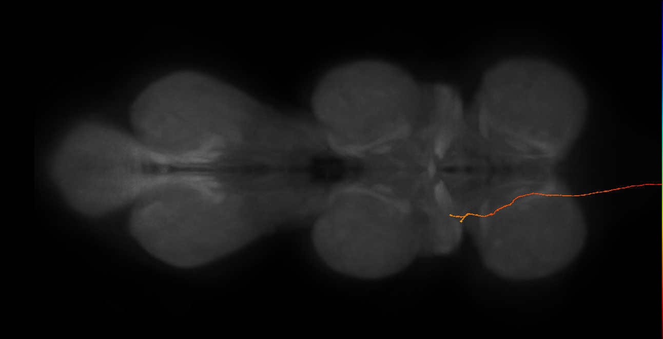 DNg10_R (MaleCNS:48924)