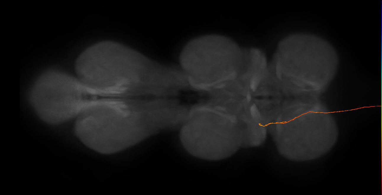 DNg10_R (MaleCNS:46578)