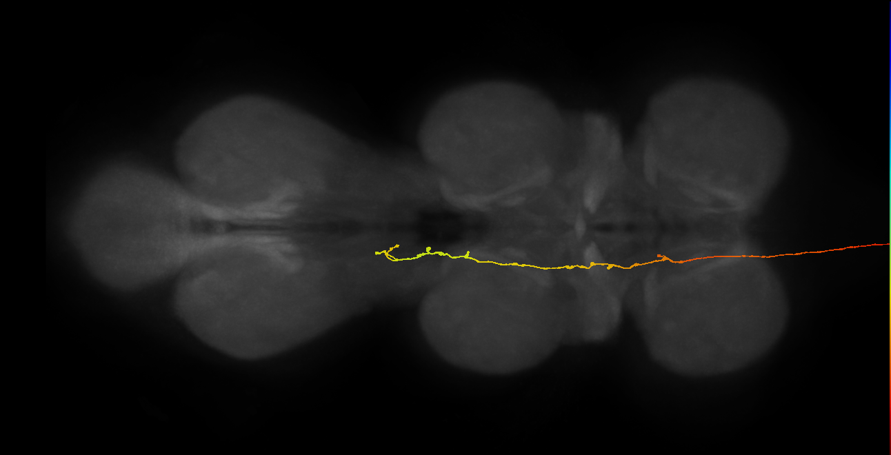 DNg11_R (MaleCNS:15568)