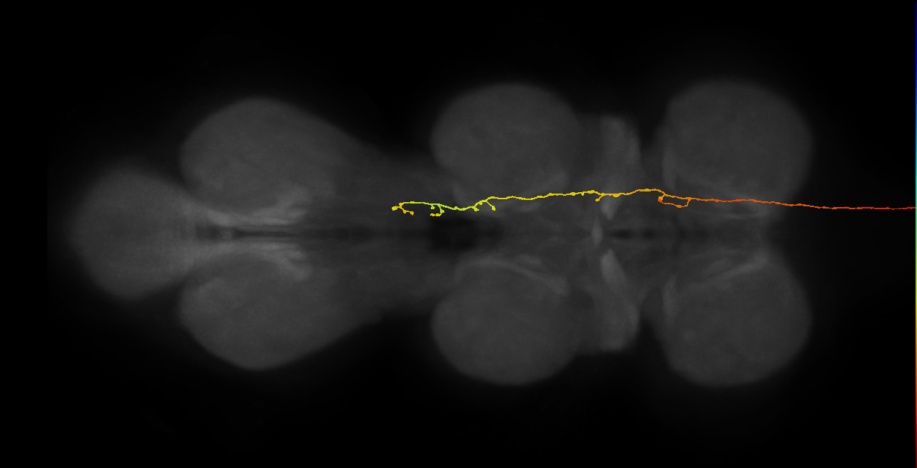 DNg11_L (MaleCNS:16399)