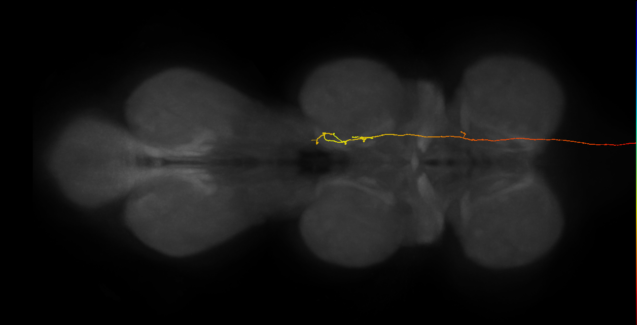 DNg18_b_L (MaleCNS:67107)