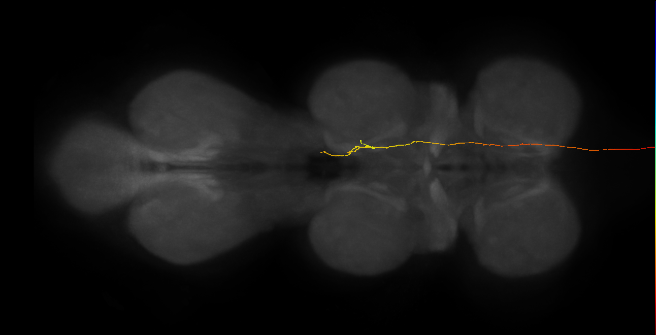 DNg18_b_L (MaleCNS:73541)