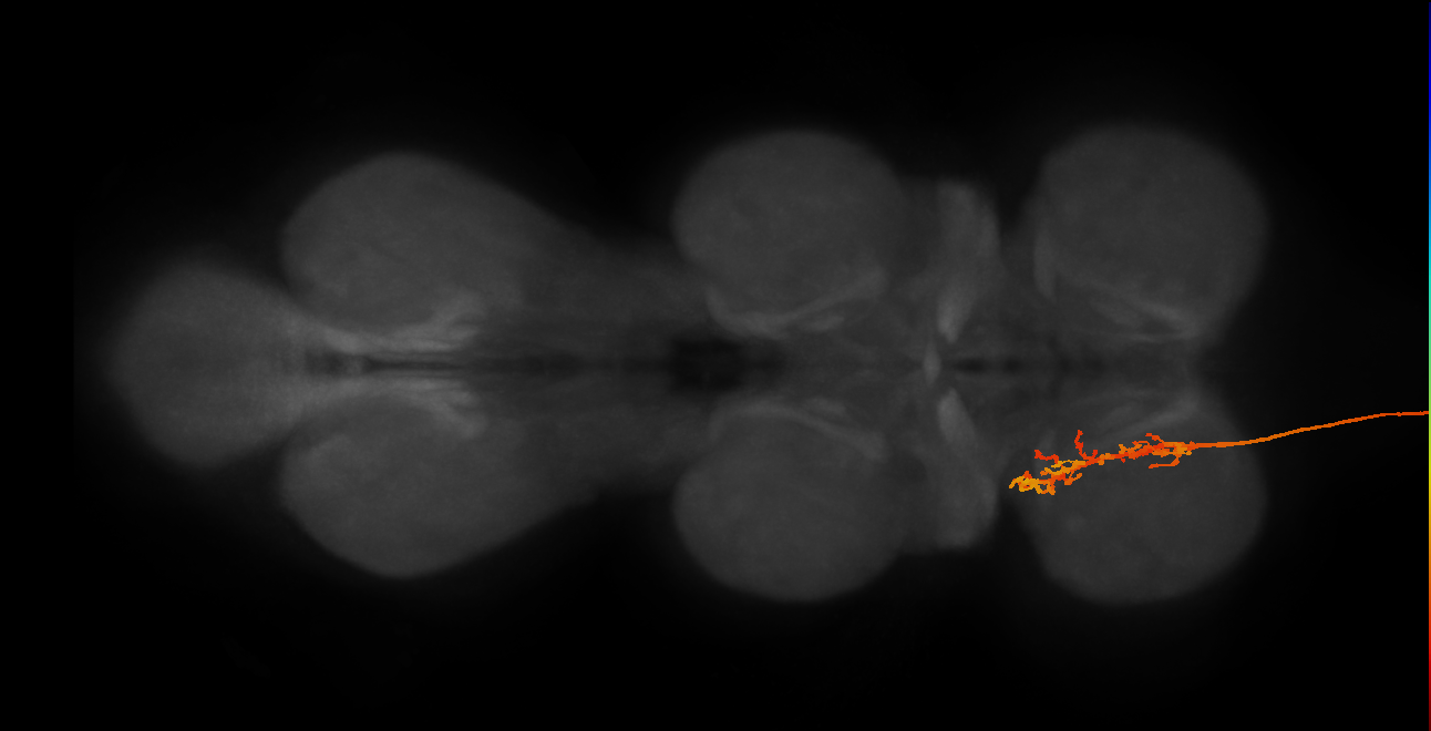 DNg49(hb1405978277)_R (MaleCNS:514489)