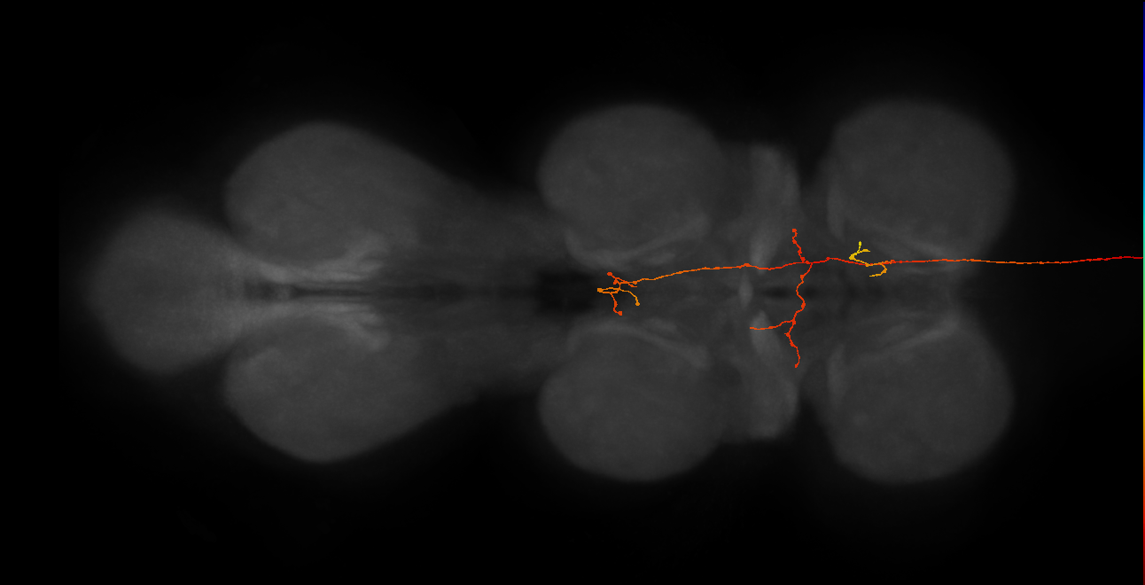 DNg92_b_R (MaleCNS:532787)