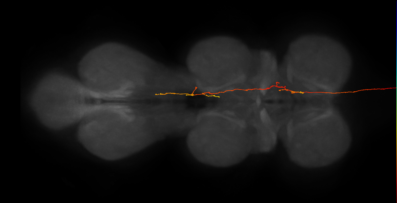 DNge017_R (MaleCNS:27607)