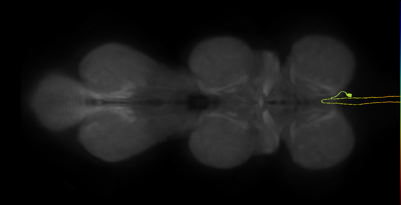 AN01A086