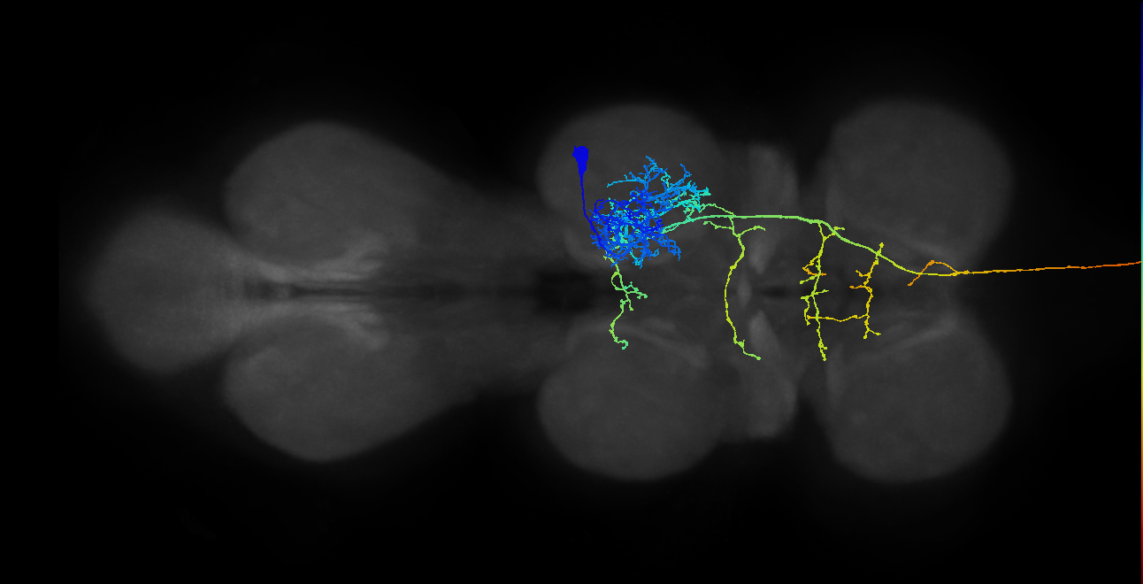 metathoracic neuron
