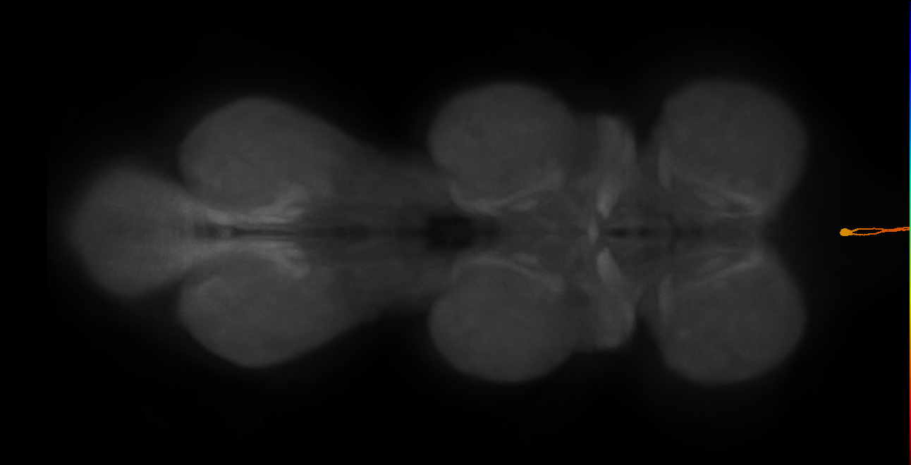 ANXXX470_M (MaleCNS:17554)