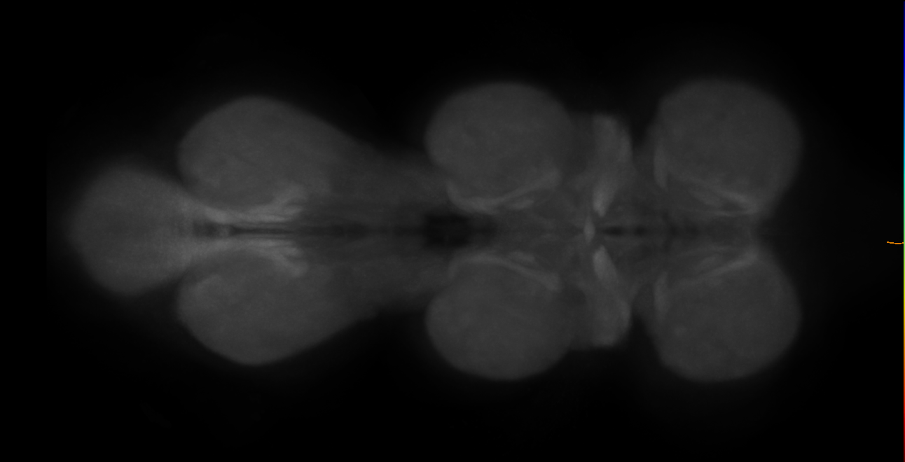 AVLP547_L (MaleCNS:14241)